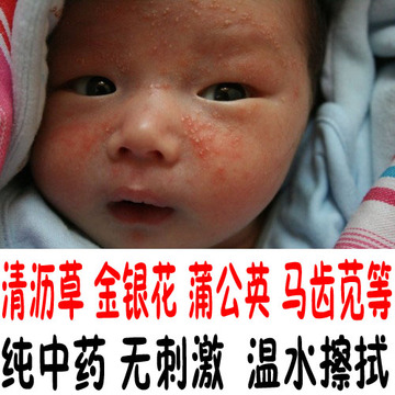 中药中草药新生婴儿幼儿童宝宝皮肤瘙痒湿疹红斑红疹清热止痒排毒